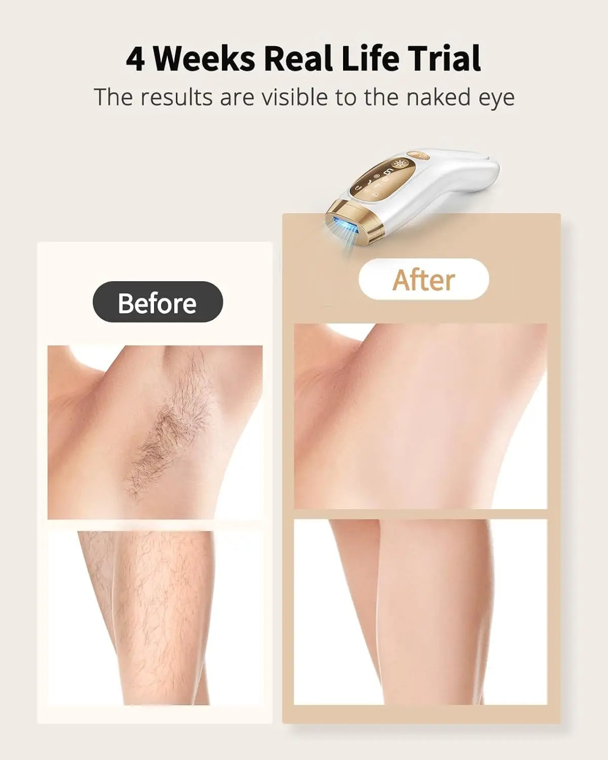 Épilateur à Lumière Pulsée IPL – 9 Niveaux, Flash Illimité, Refroidissement Ice-Cooling, Résultats Durables